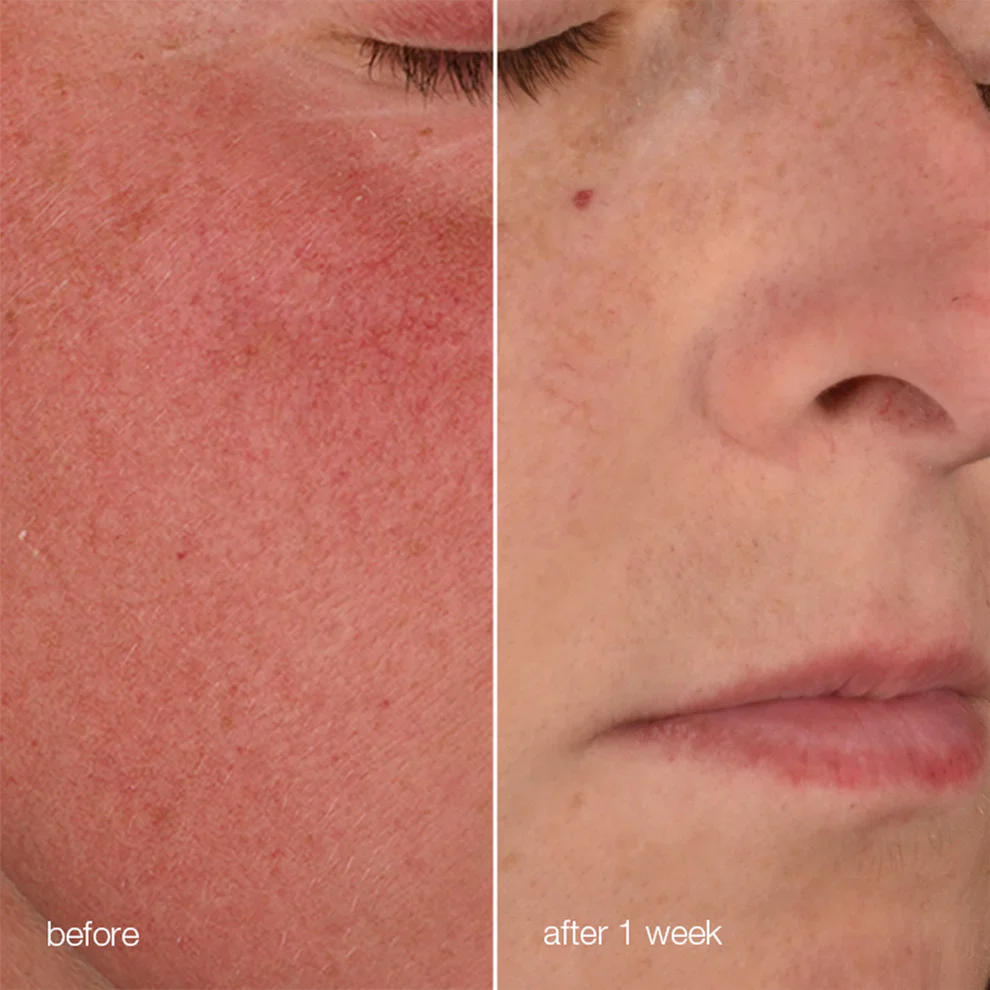 Dermalogica Ultra Calming Stablizing Repair Cream - Image 6